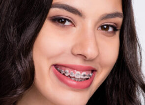 אישה עם גשר בשיניים