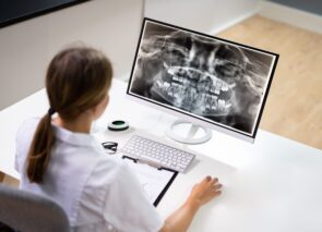 צילום שיניים